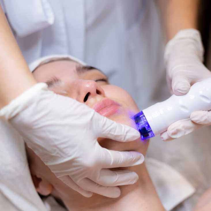 RF лифтинг шея и декольте