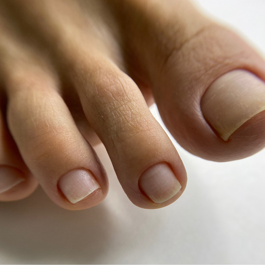 Гигиенический педикюр