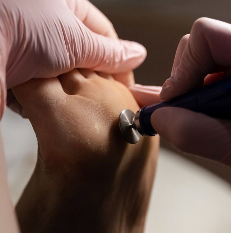 Обработка стопы