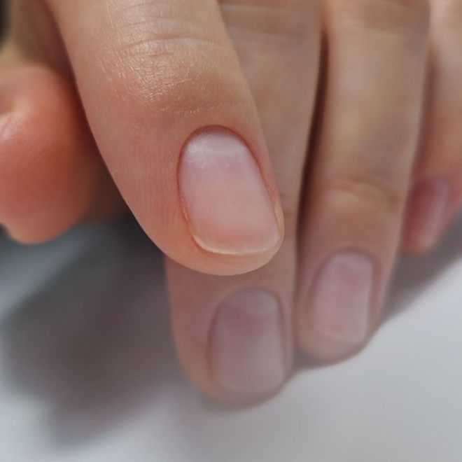 Снятие без дальнейшего покрытия