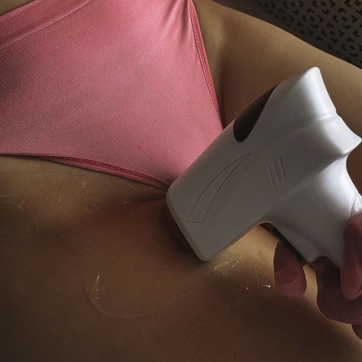 ЛАЗЕР: Бикини классика