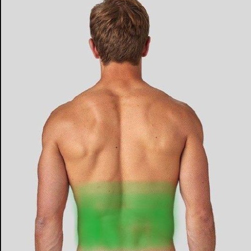 Лазерная эпиляция мужская: нижняя часть спины