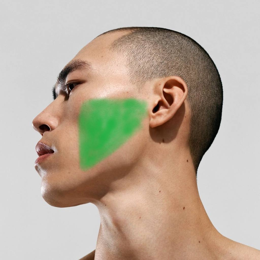 Лазерная эпиляция мужская: скулы