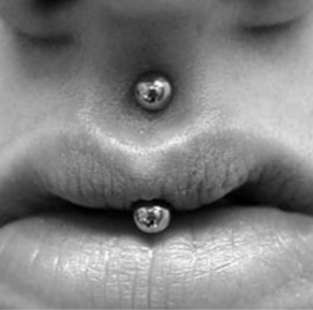 Прокол Джеструм