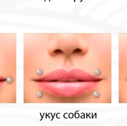 Укус собаки