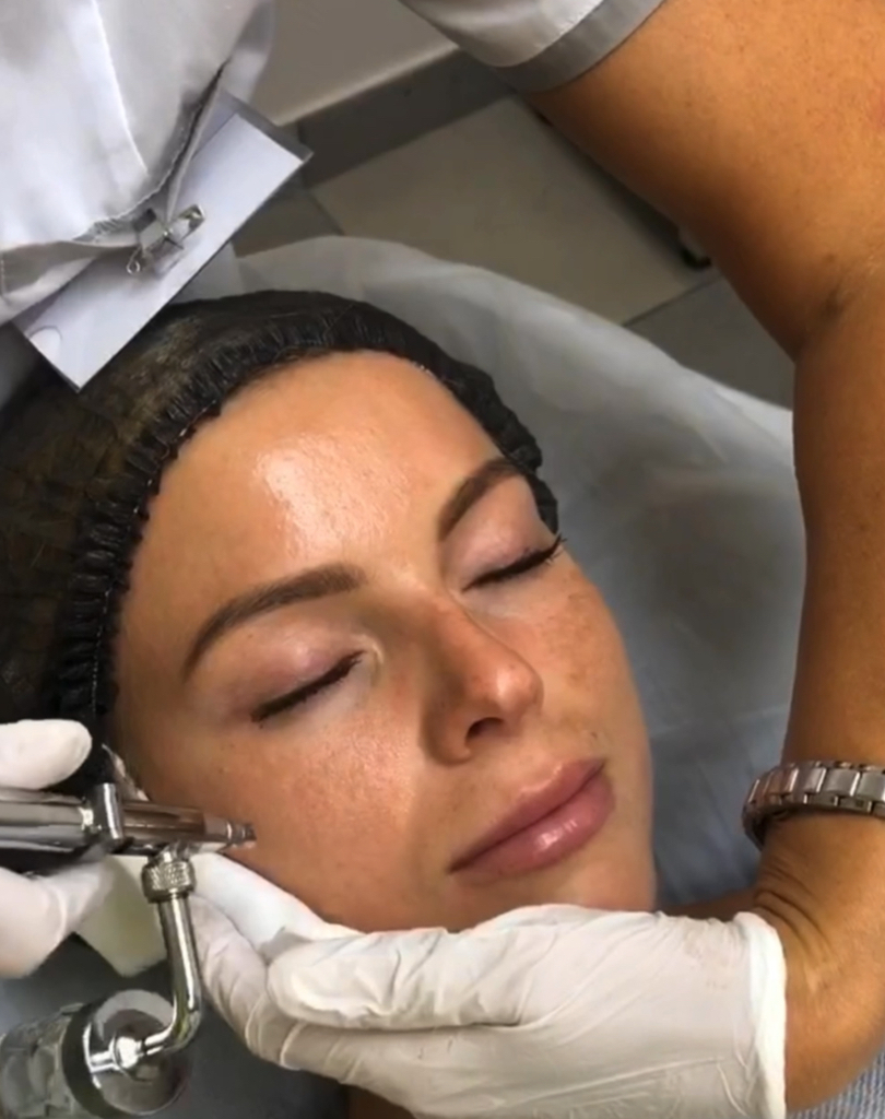 SKINDEX- процедура 3в1( газожидкостная чистка, барофорез, 3d массаж)