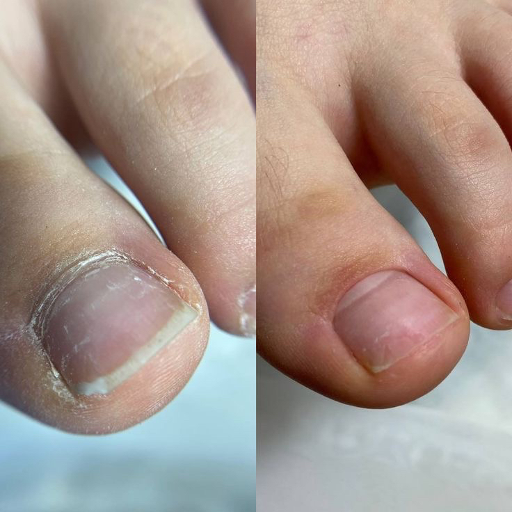 Педикюр Аппаратный без покрытия