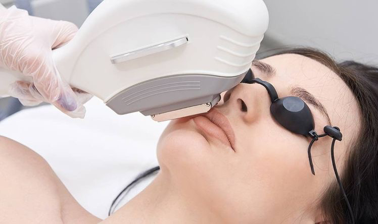 Элос омоложение (лицо и шея) - 5 сеансов