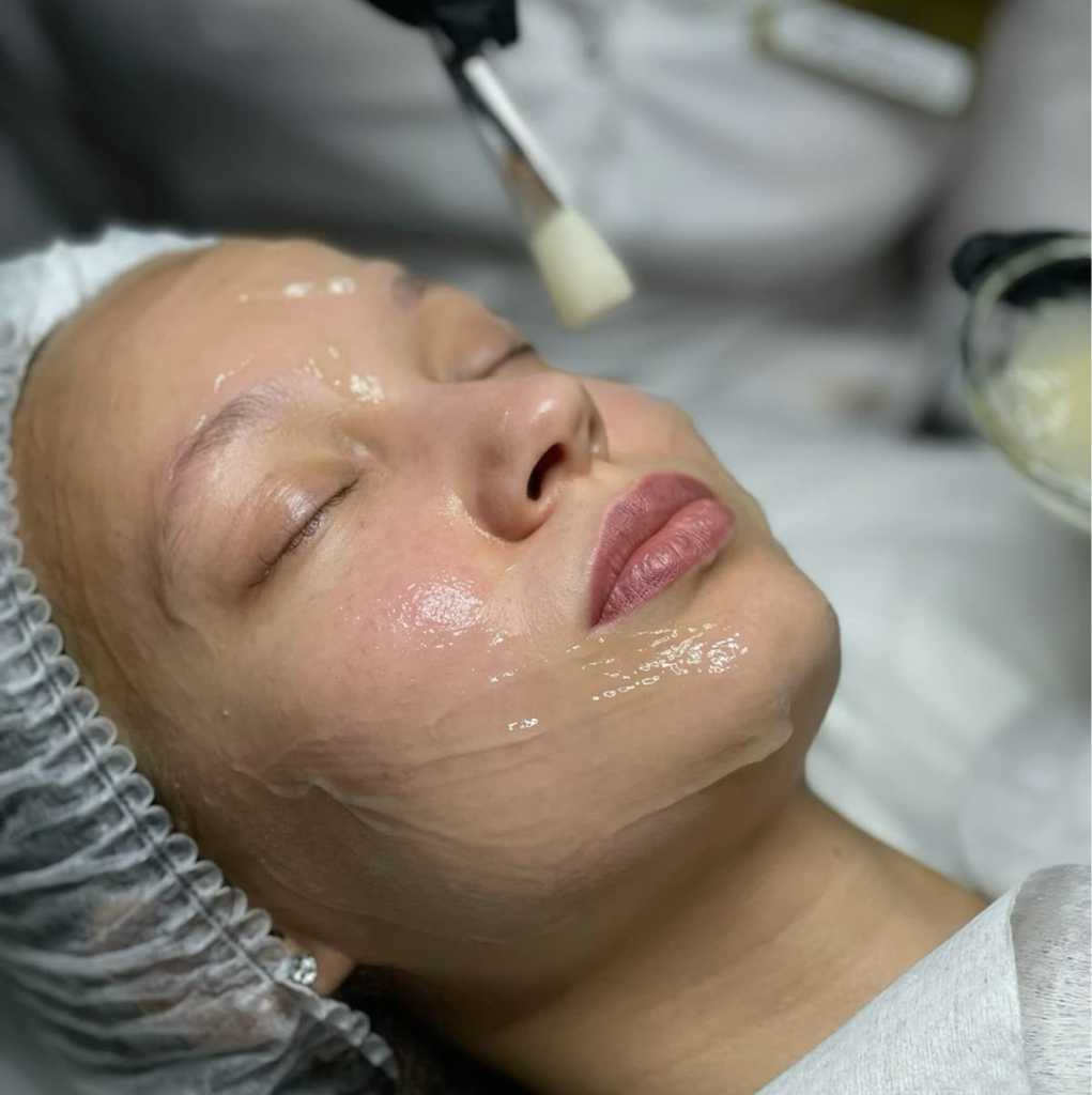 Миндальный пилинг