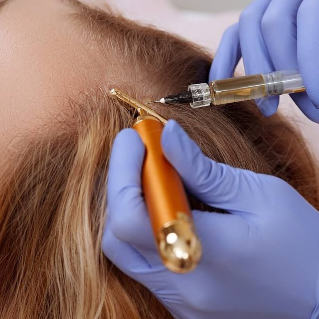 Карбокситерапия