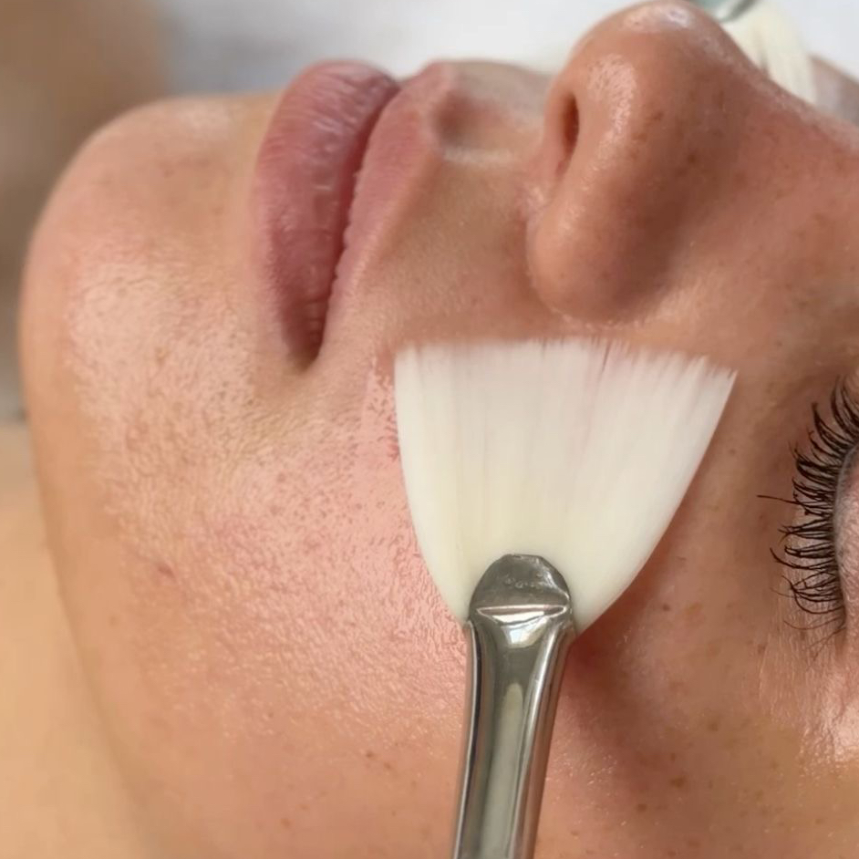 Пилинг Джесснра