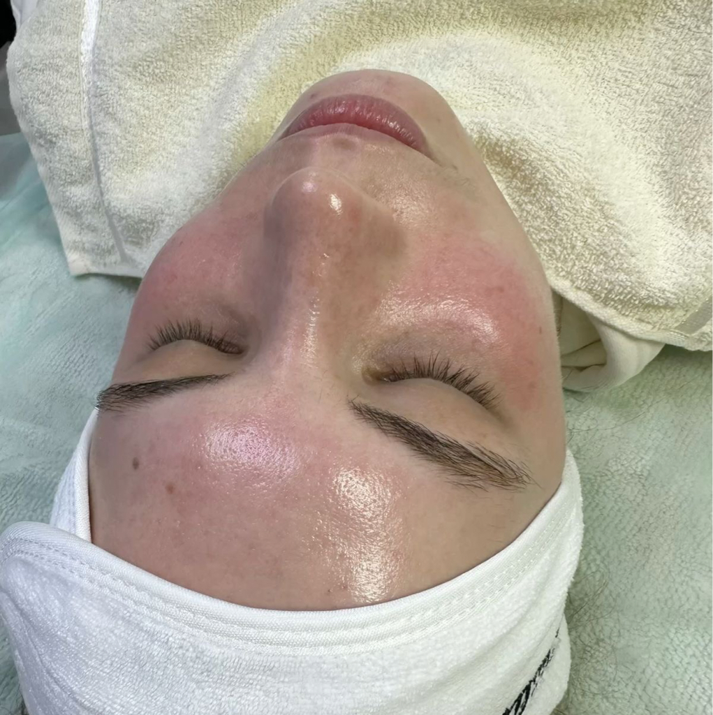 Комбинированная чистка лица  (вакуумная чиста + механическая + пилинг + подбор домашнего ухода)