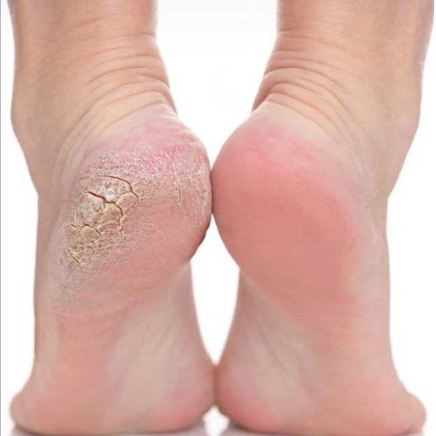 педикюр полный без покрытия пальчиков гель-лаком