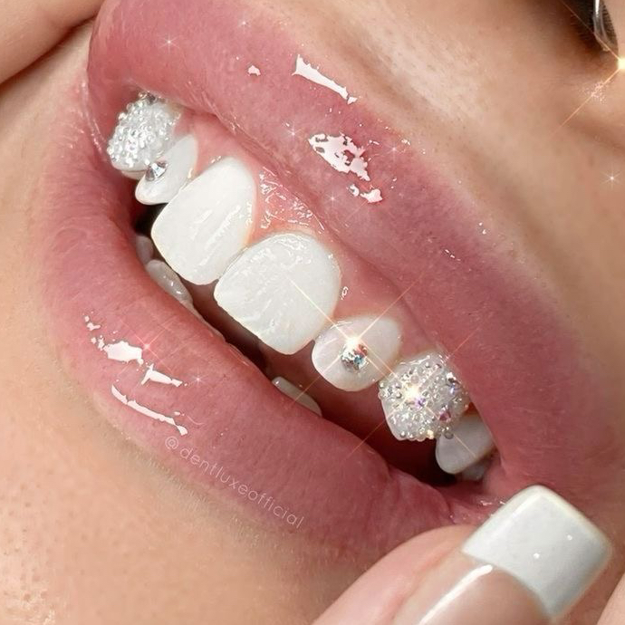 Второй и каждый последующий скайс