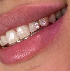 Скайс (1-3 шт)