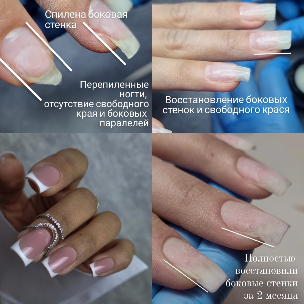 Сложная коррекция