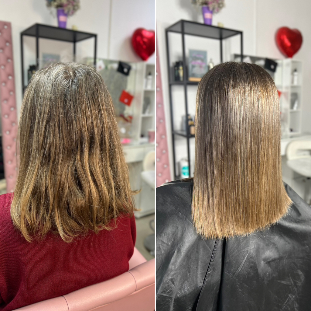 Послойное протезирование (ведущий технолог)