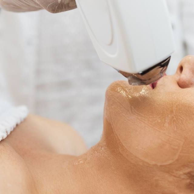 ЛЭ-Любая зона лица (верхняя губа)