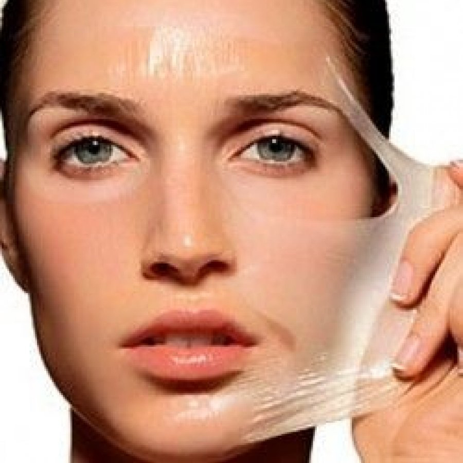 Всесезонный химический поверхностный пилинг