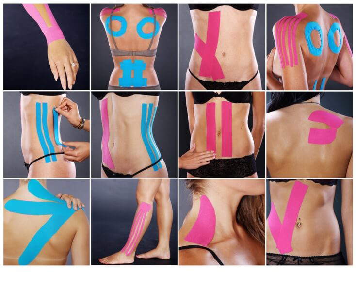 Kinesio-Taping von problematischen Körperbereichen – zu therapeutischen, vorbeugenden oder ästhetischen Zwecken. Preis ab 5 € pro beklebter Zone. Кине