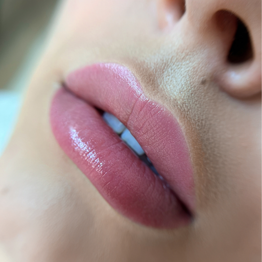 Коррекция ПМ губ