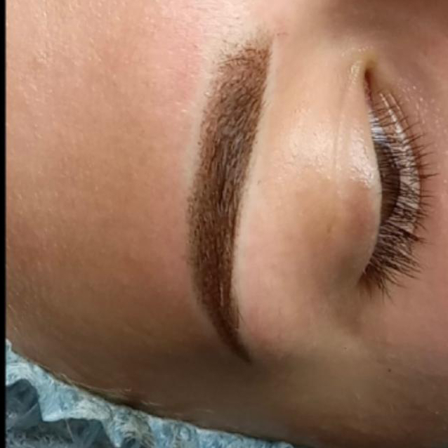 Удаление тату ремувером