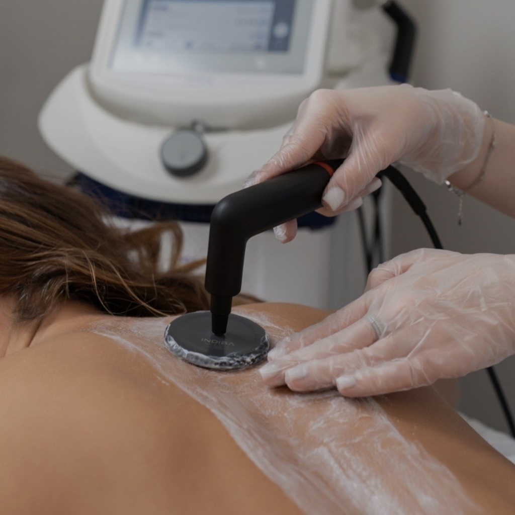 Индиба тело ( Монополярный Радиолифтинг)