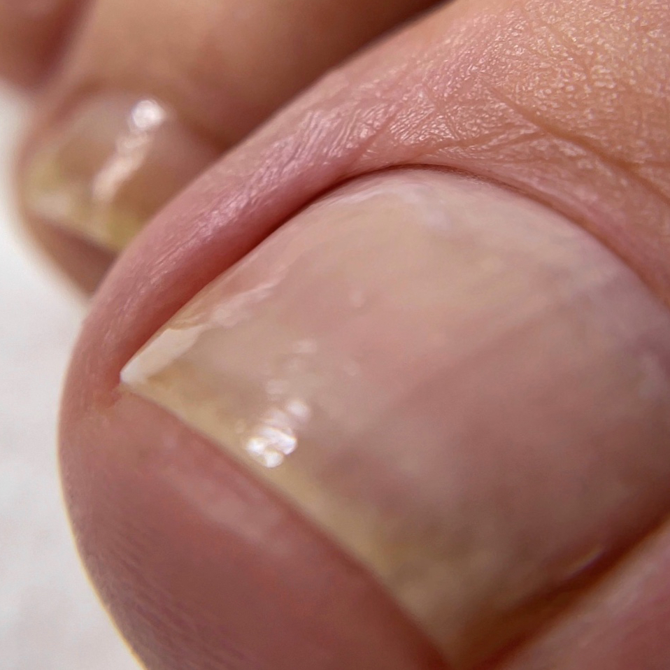 Педикюр гигиенический без покрытия