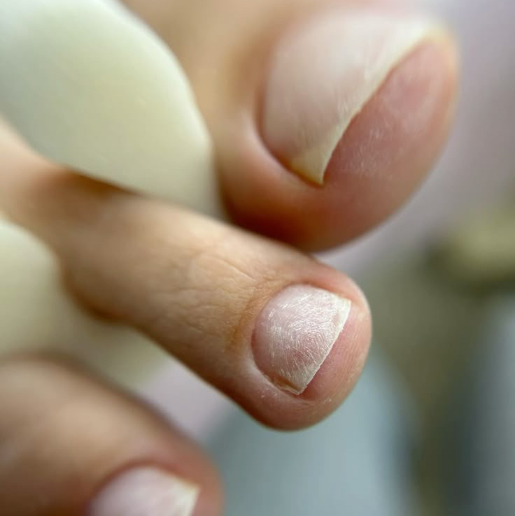 Педикюр.Комплекс «XS пальчики»