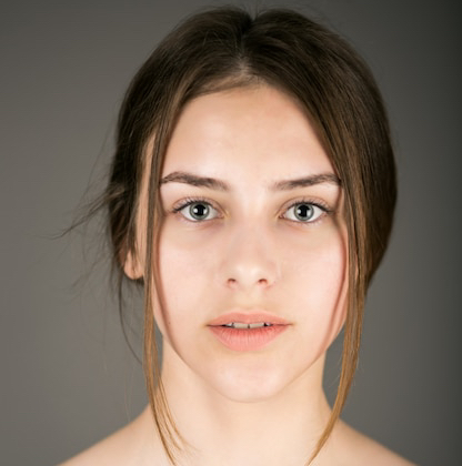 Лазер верхняя губа