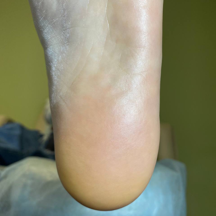 Педикюр.Комплекс «XS стопа»