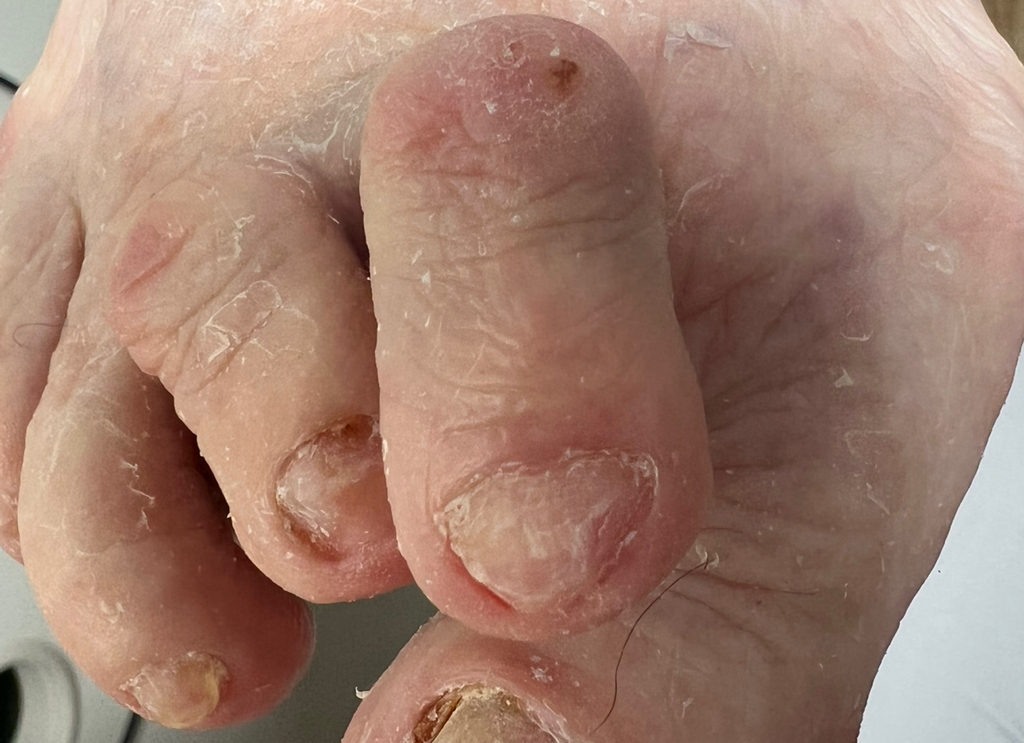 Подопедикюр