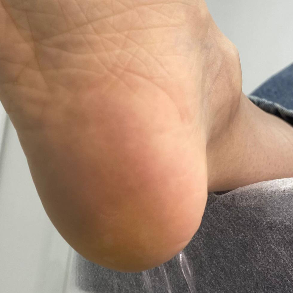 Подопедикюр