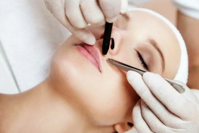 Электроэпиляция ЛИЦА