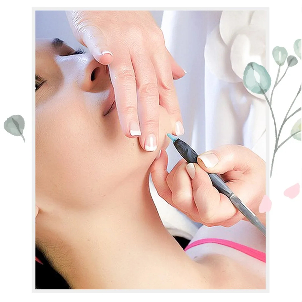 Электроэпиляция ЛИЦА