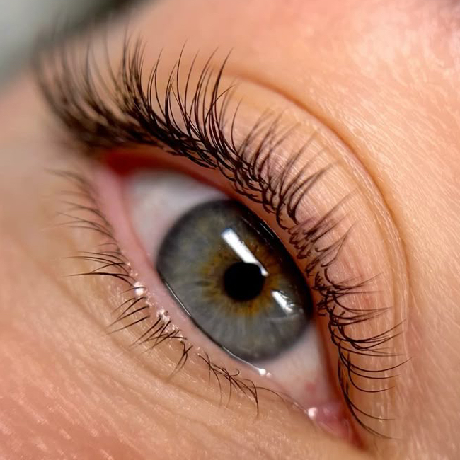 Классическое наращивание 1-1,5D