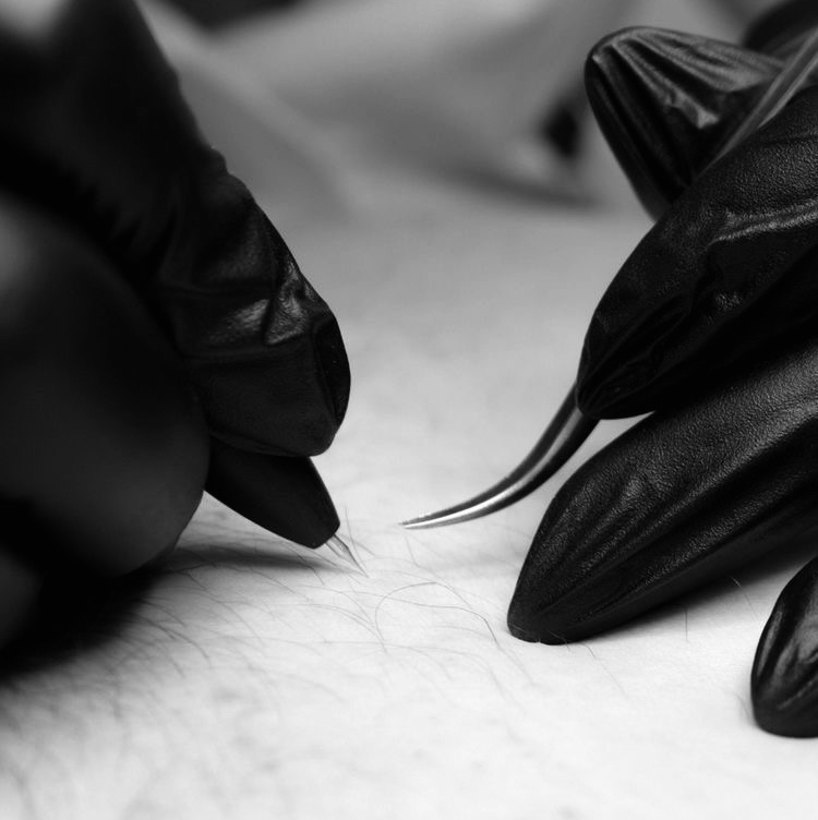 MEN Электроэпиляция 2 часа