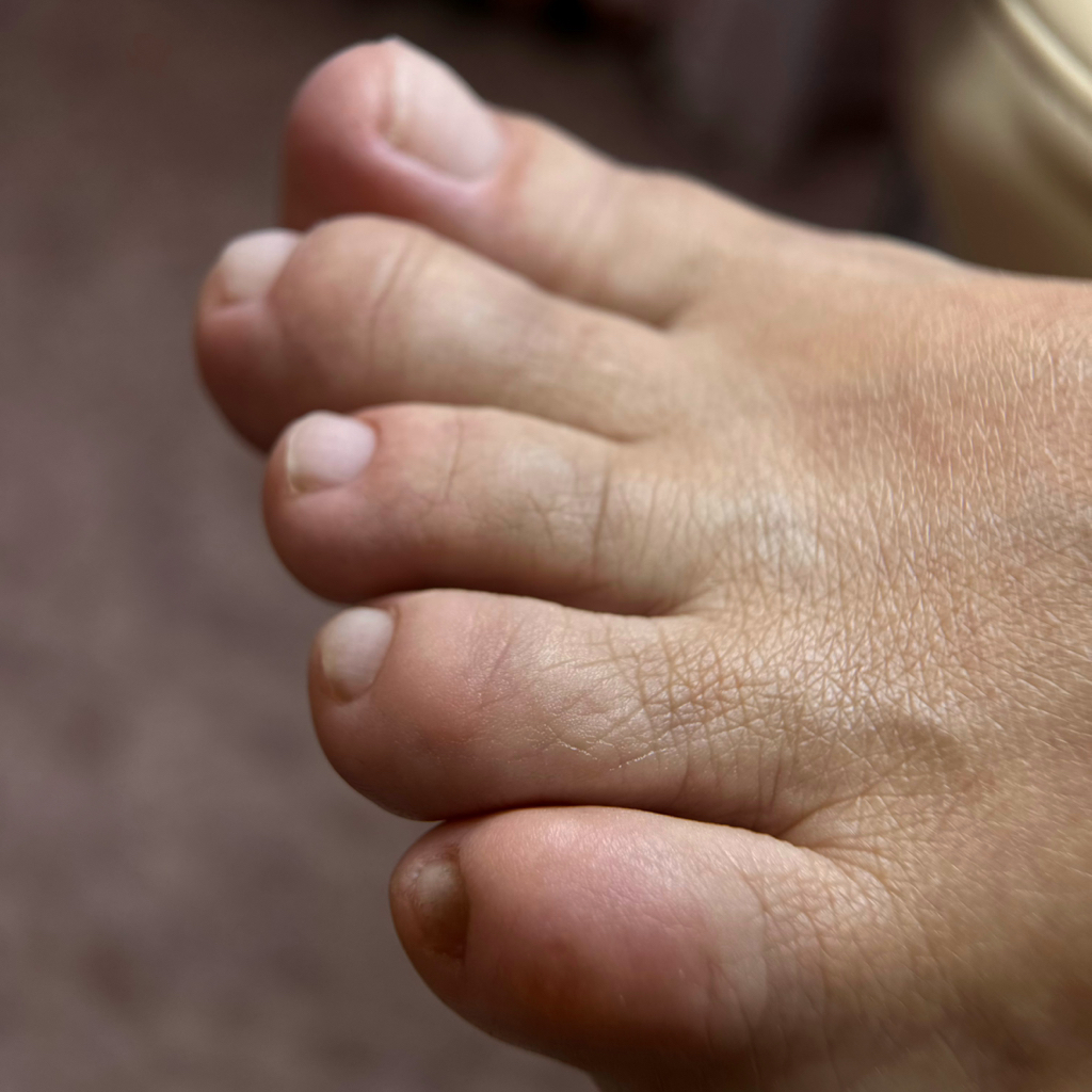 Педикюр (обработка пальцев)