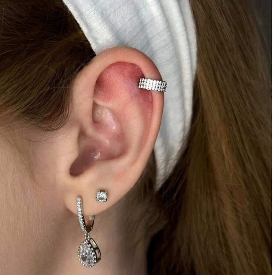 Замена украшения