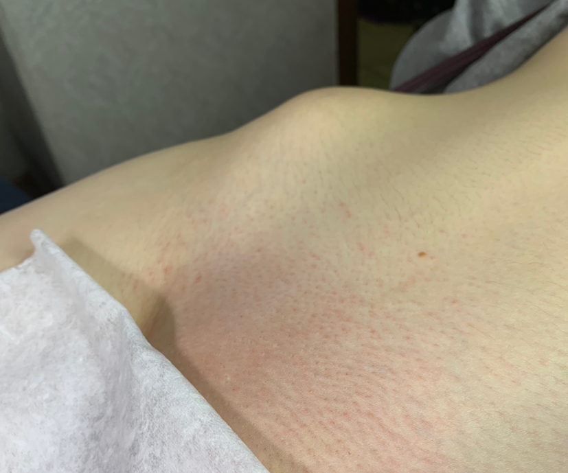 Глубокое бикини