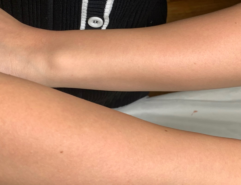 Руки полностью