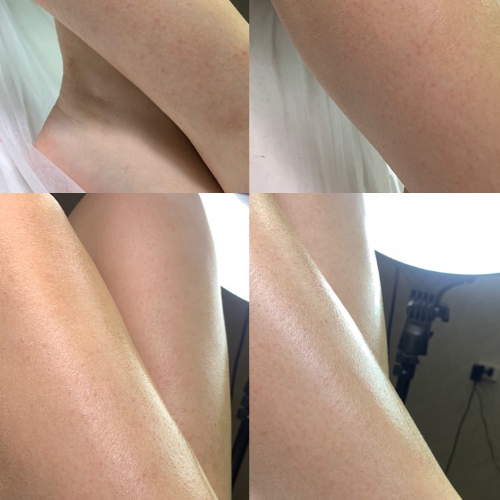 Комплекс 2 (глубокое бикини+подмышки+голени/бедра)