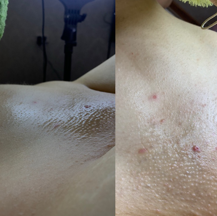 Комплекс 3 (глубокое бикини+подмышки+ноги полностью)