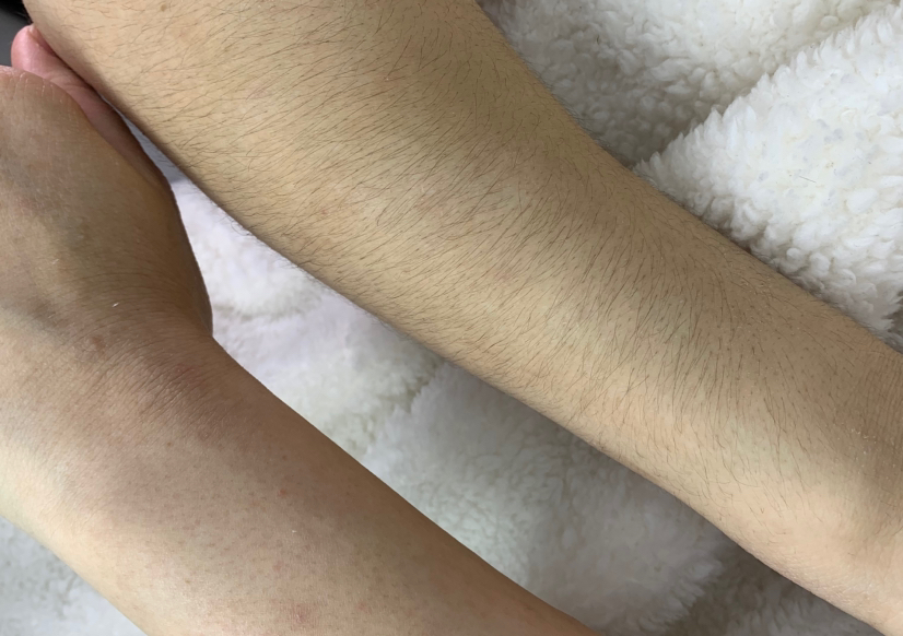 Руки до локтя