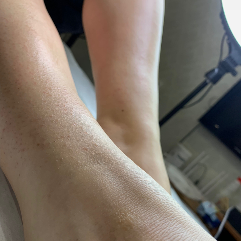 Комплекс 5 (подмышки+ноги полностью)