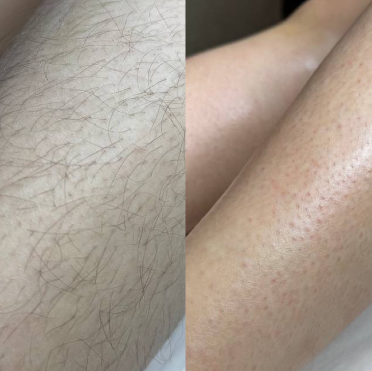 Ноги полностью