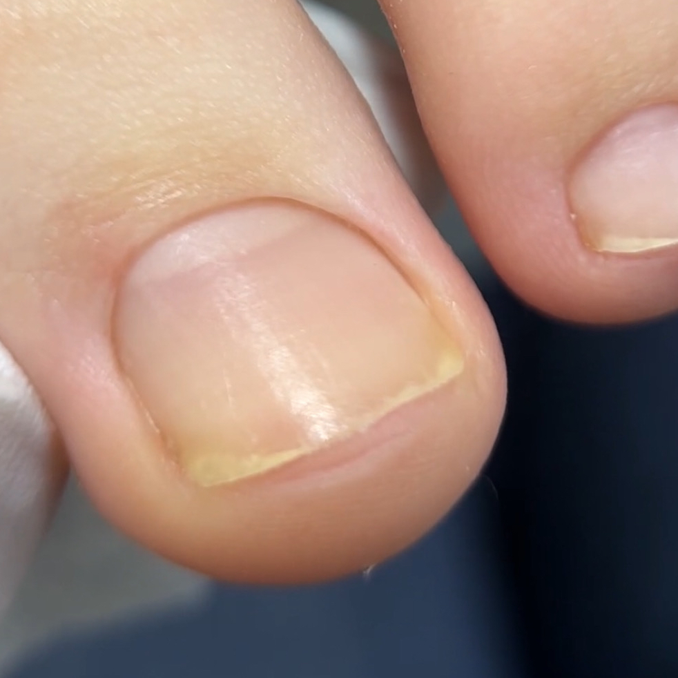 Обработка пальцев без покрытия