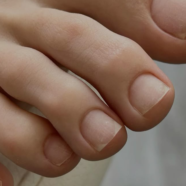 Педикюр снятие+ коррекция длины