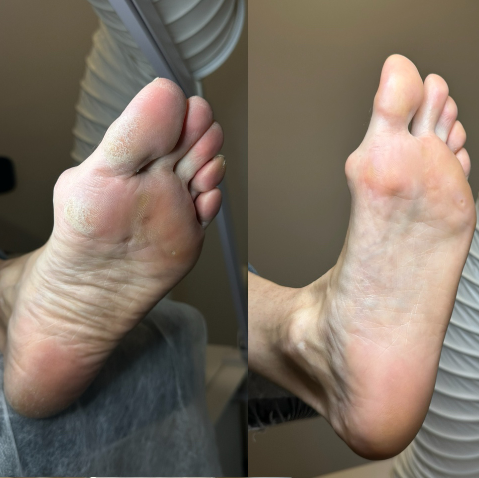 Полный педикюр без покрытия