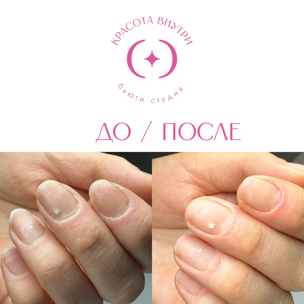 Маникюр гигиенический